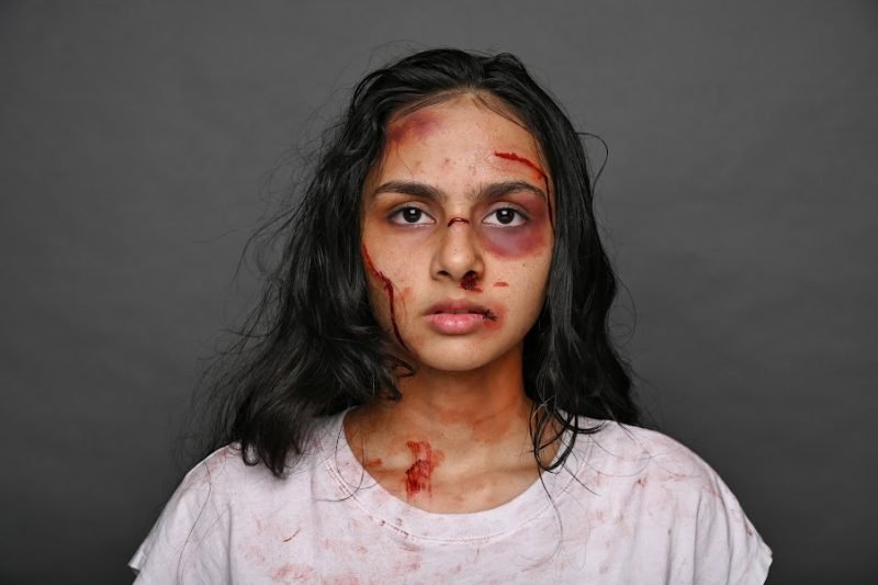 Special-effects makeup simulating cuts and bruising, worn with a stained white top against a grey backdrop