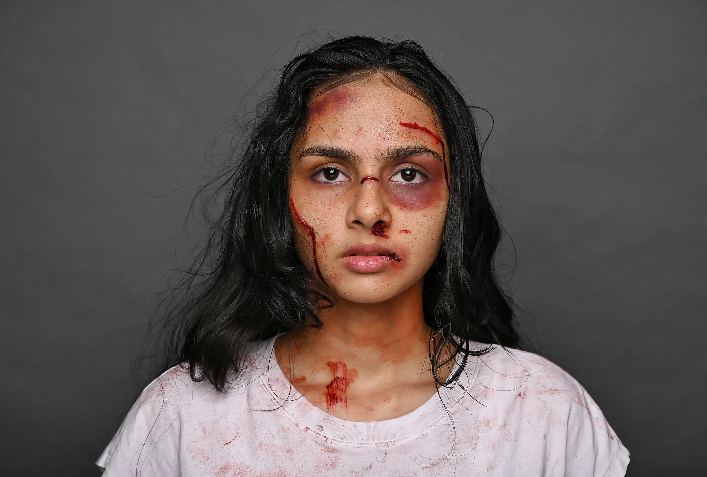 Special-effects makeup simulating cuts and bruising, worn with a stained white top